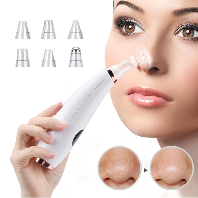 Electric Acne Remover